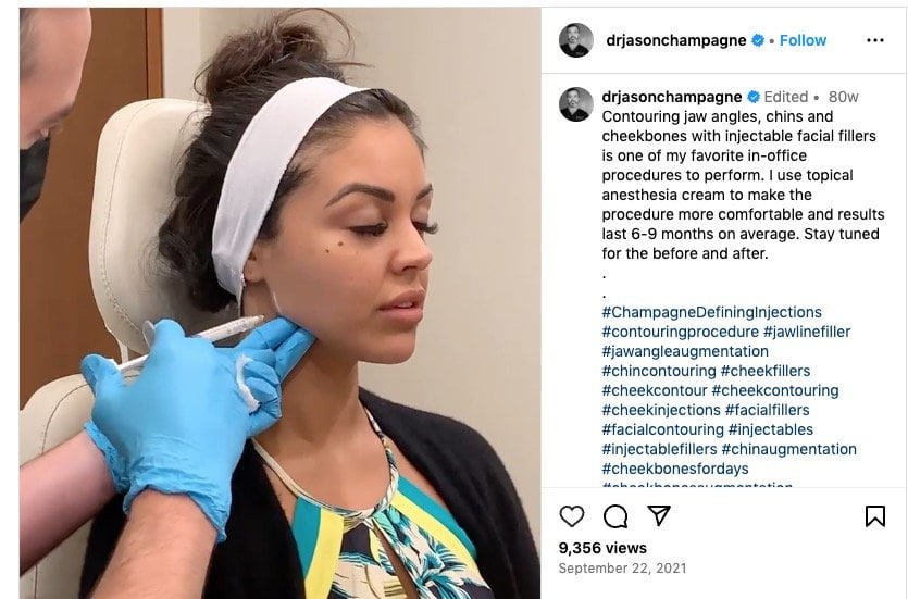 Champagne ElixirFill Therapy® 1 Champagne ElixirFill Therapy