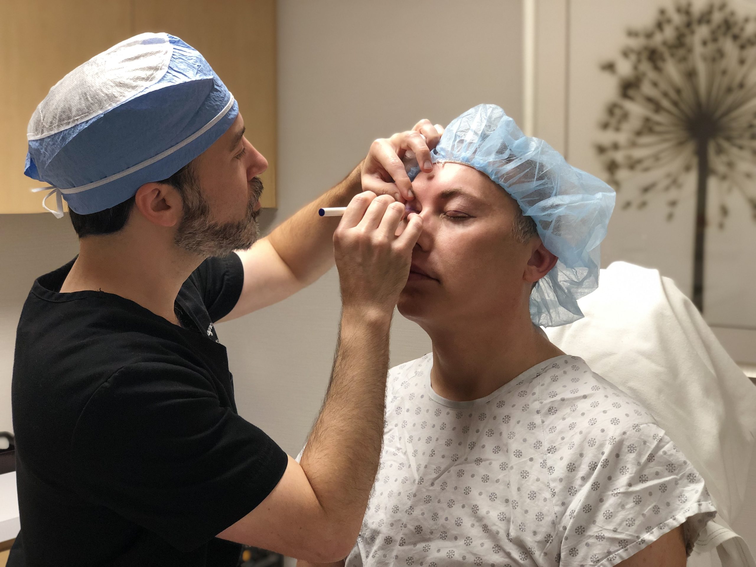 Blepharoplasty in Beverly Hills, Los Angeles