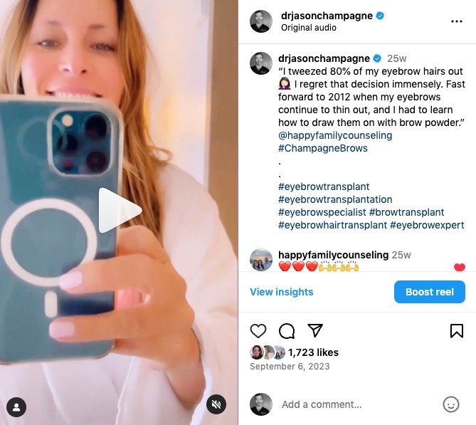 Danielle's Journey: A Transformative Experience with Champagne Brows® 2 Danielle's Champagne Brows Journey