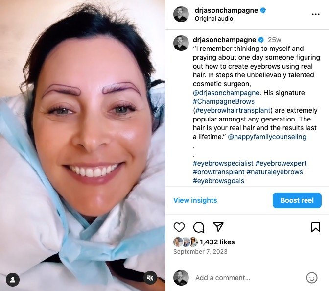 Danielle's Journey: A Transformative Experience with Champagne Brows® 3 Danielle's Champagne Brows Journey