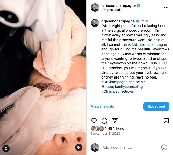 Danielle's Journey: A Transformative Experience with Champagne Brows® 4 Danielle's Champagne Brows Journey