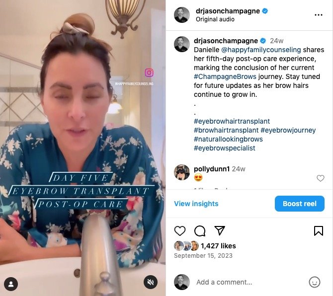 Danielle's Journey: A Transformative Experience with Champagne Brows® 5 Danielle's Champagne Brows Journey
