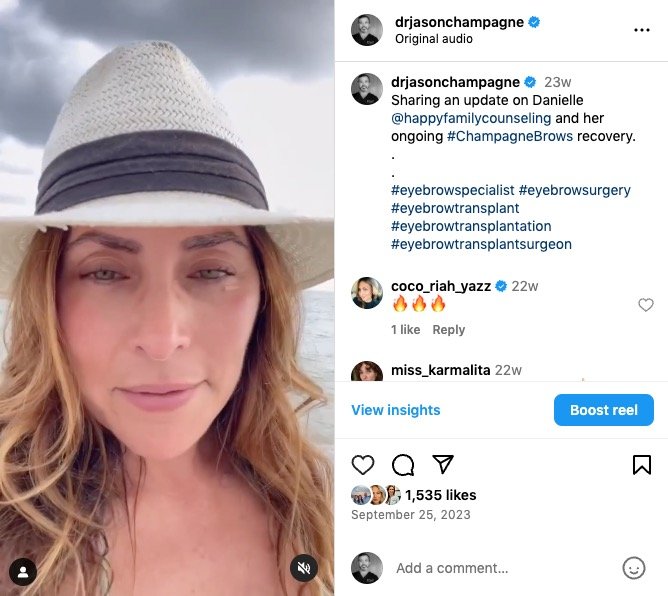 Danielle's Journey: A Transformative Experience with Champagne Brows® 6 Danielle's Champagne Brows Journey