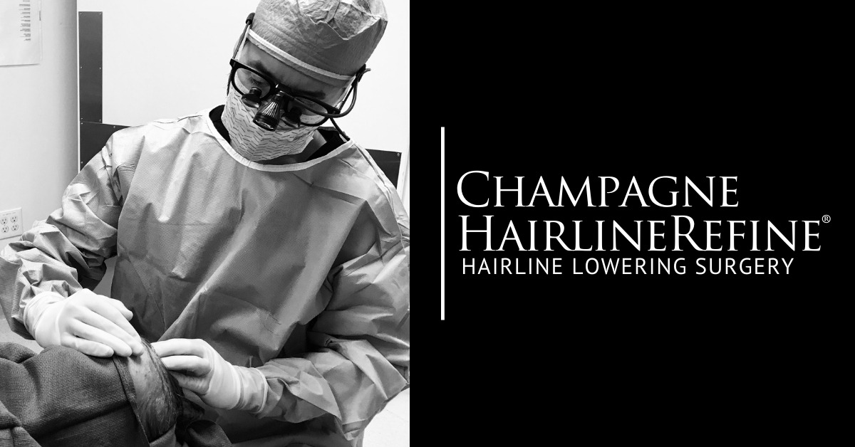 Hairline Lowering | Champagne HairlineRefine |Hairline Lowering Surgery