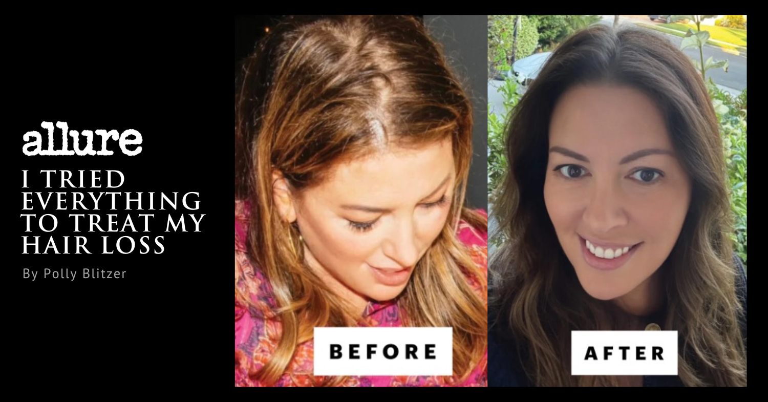 Allure On Dr. Jason Champagne - Hair loss Solutions