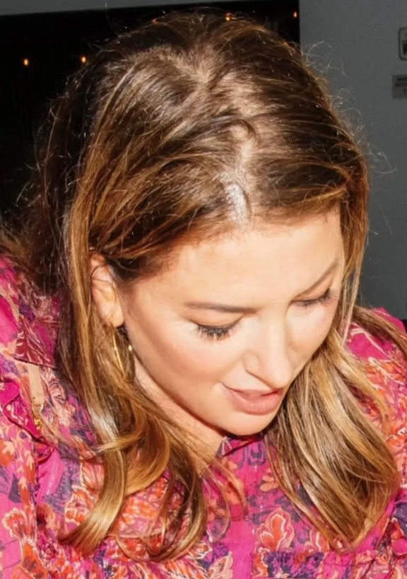 Allure: I Tried Everything to Treat My Hair Loss 2 Allure-On Hair Loss - Dr. Champagne In The News