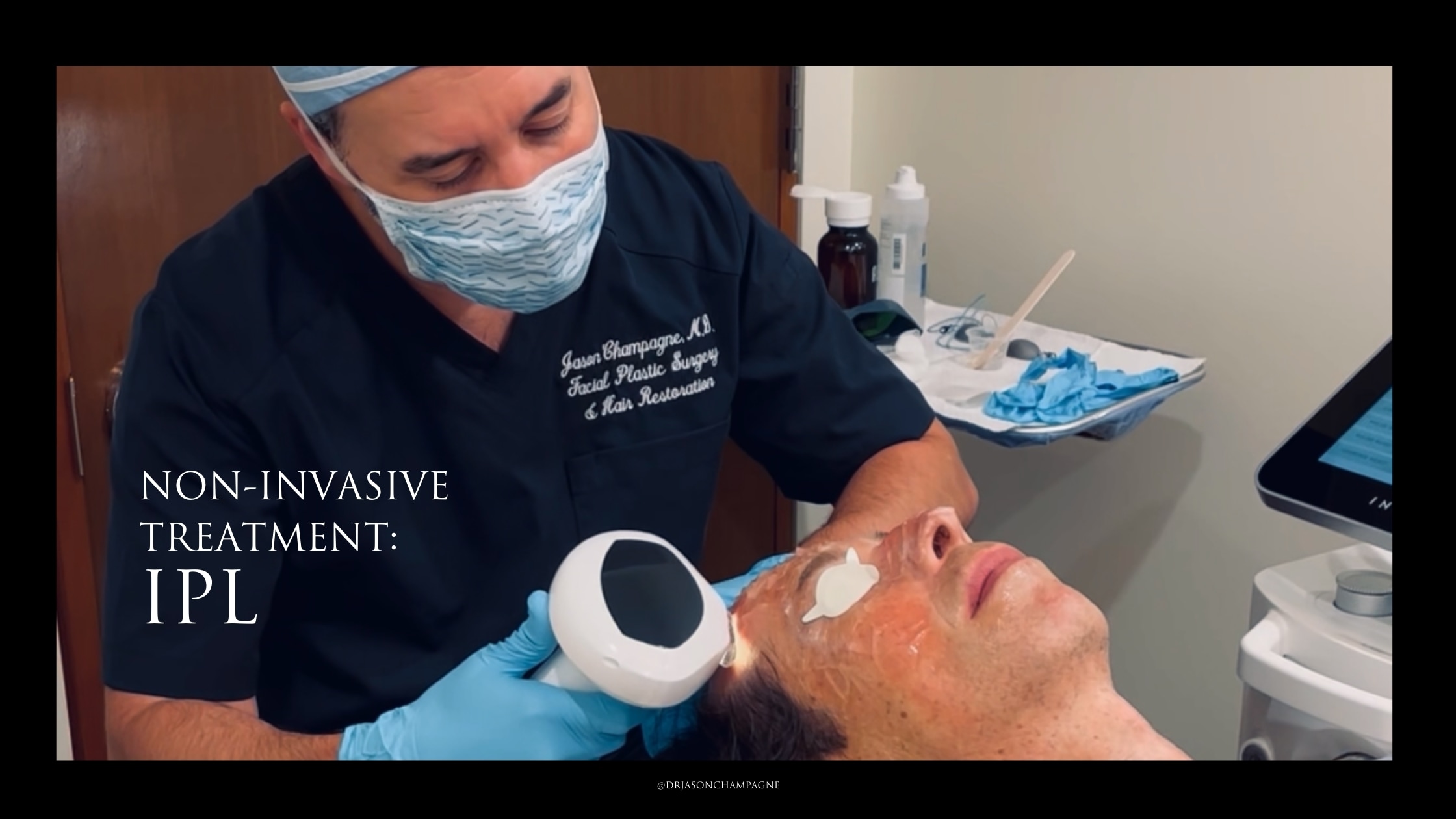 IPL Treatment _ Dr. Champagne
