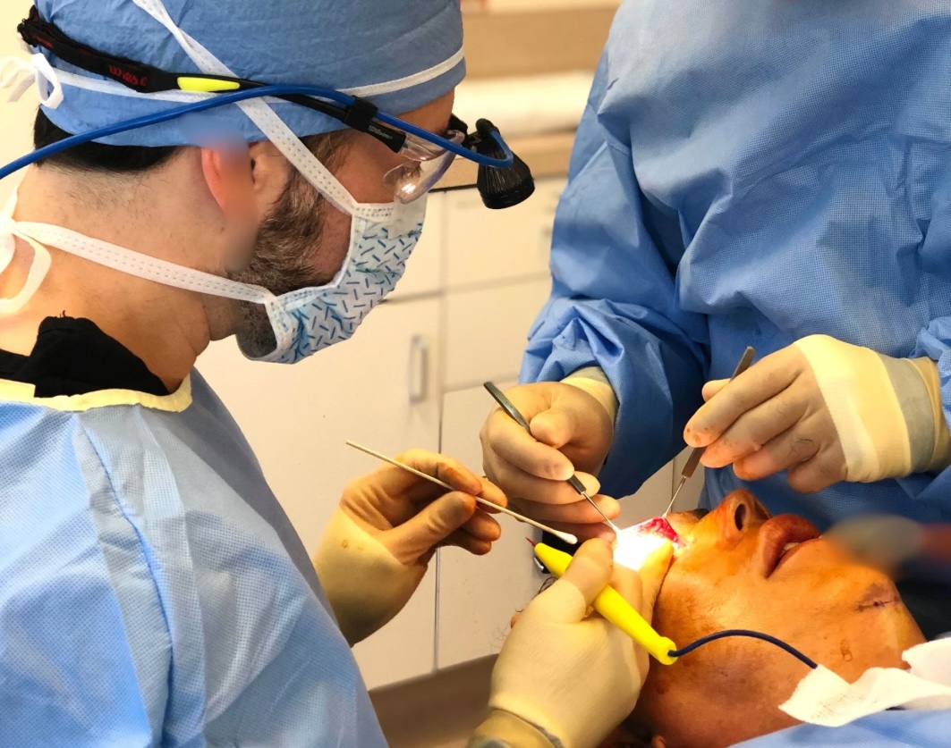 Lower Blepharoplsty | Dr. Champagne