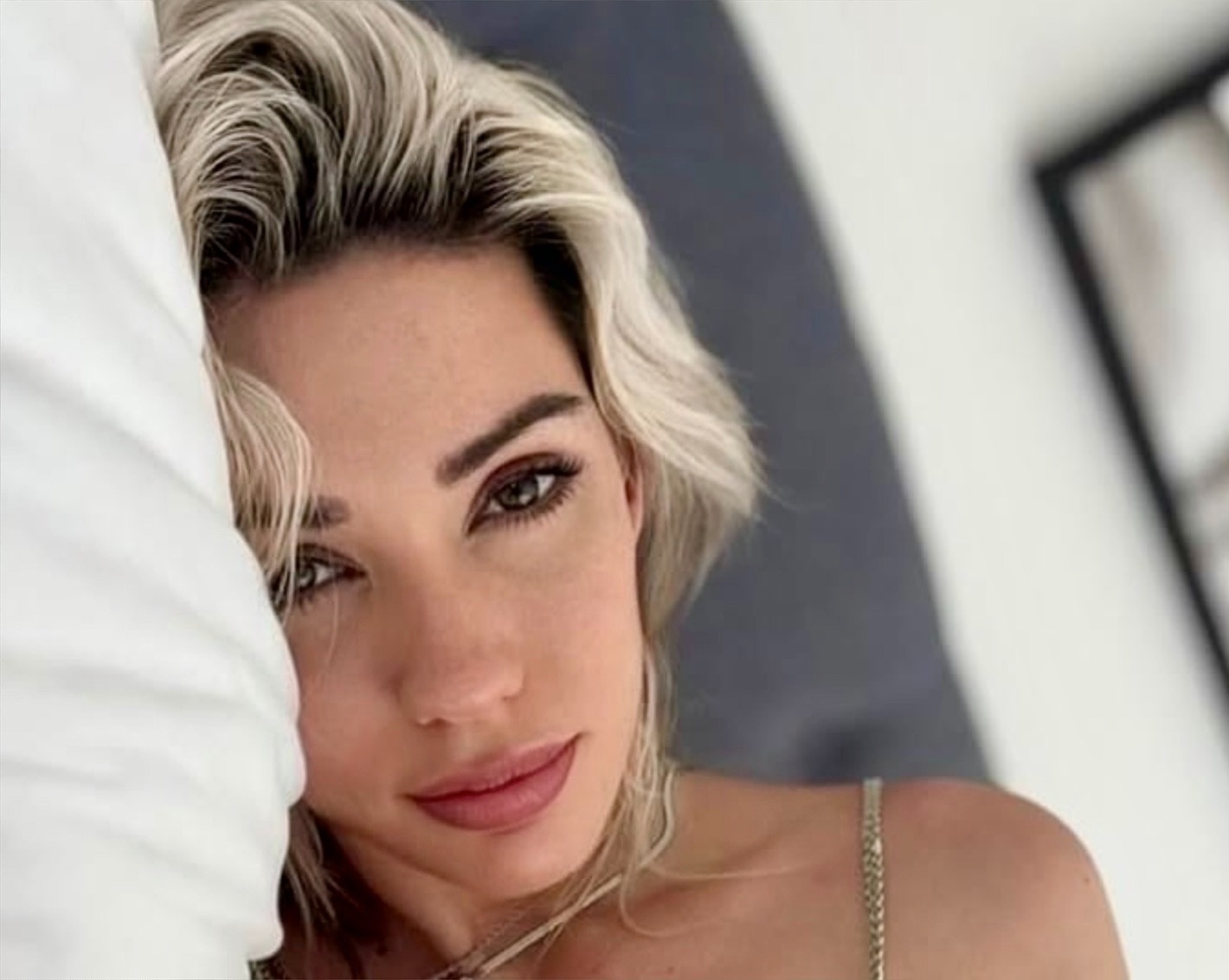 Why More Women Are Choosing Brow Transplants 2 Alanah Pearce