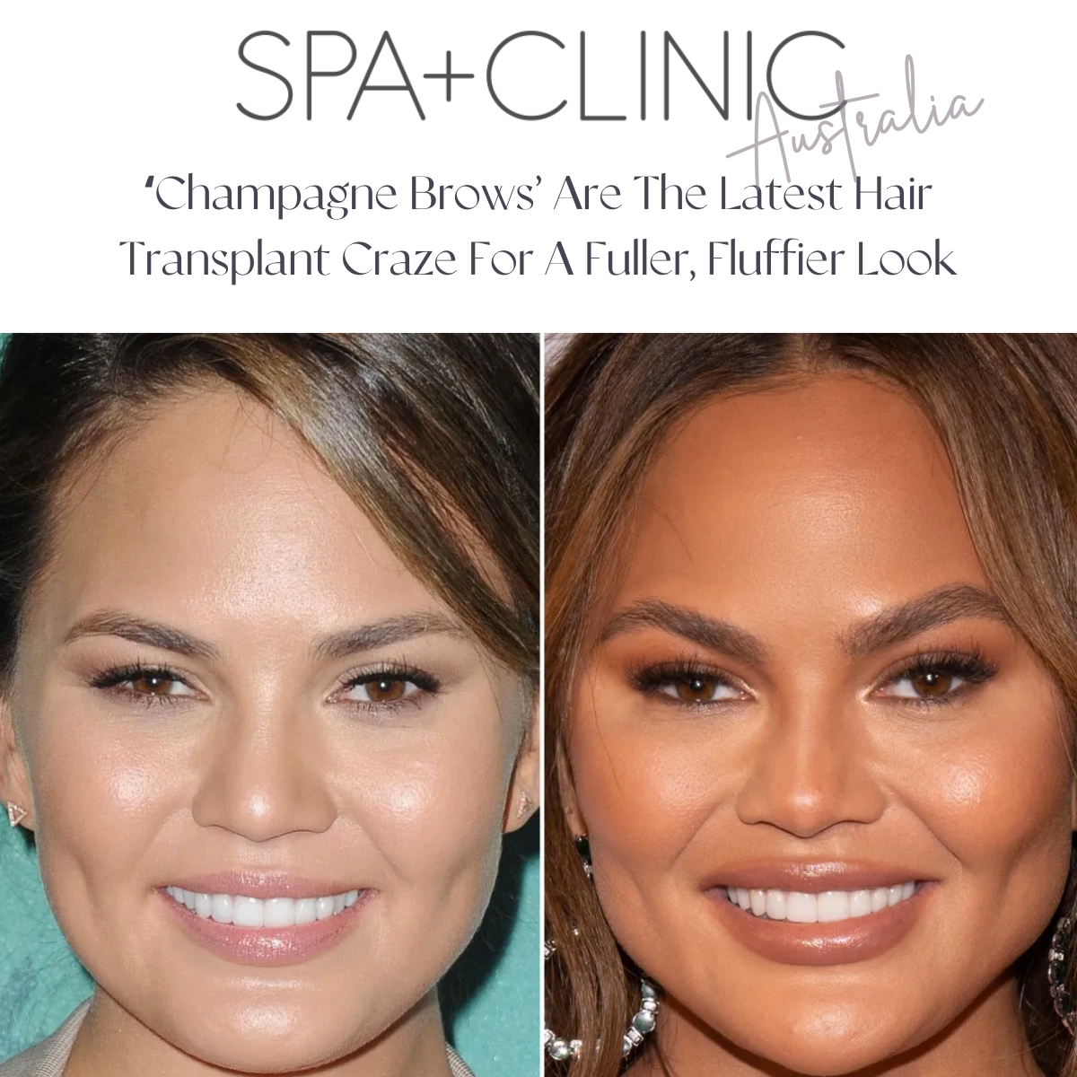 Spa & Clinic Australia feature on Dr. Champagne