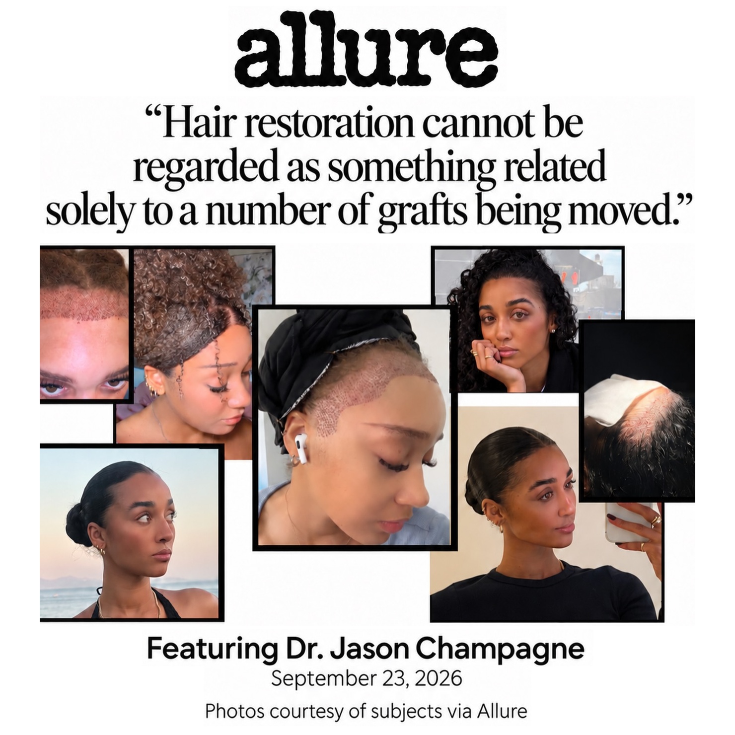 Allure feature on women’s hair transplants with commentary from Dr. Jason Champagne